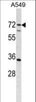 Polyclonal Rabbit anti-Human CDADC1 Antibody (aa483-512, WB)