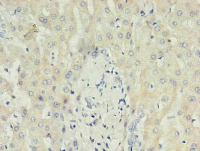 CRP / C-Reactive Protein Antibody (clone 15E7B4)