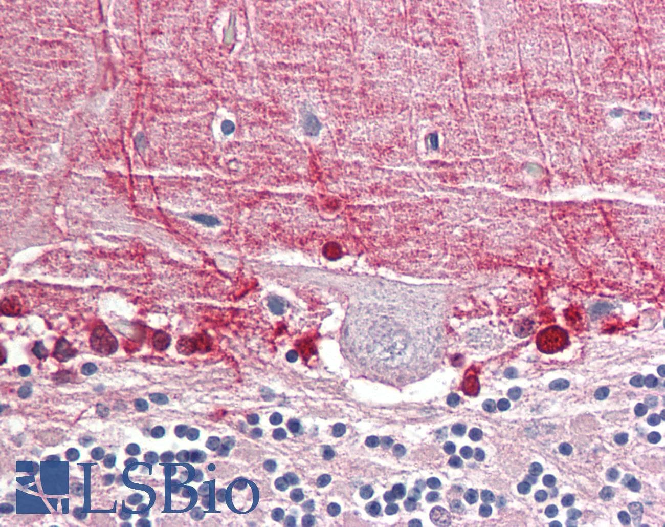 IHC-plus™ KPI-2 / LMTK2 Antibody (aa651-700)
