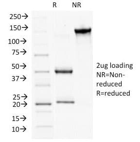 Monoclonal Mouse anti-Human PKP1 / Plakophilin 1 Antibody (clone 10B2, Azide-free,BSA-free, IF, WB)