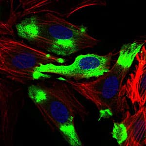 Monoclonal Mouse anti-Human CD22 Antibody (clone 1A3A11, aa621-725, IF, WB)