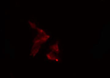 Arkadia / RNF111 Antibody