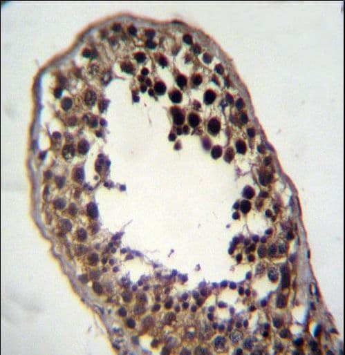 FSTL3 / FLRG Antibody (aa229-258)