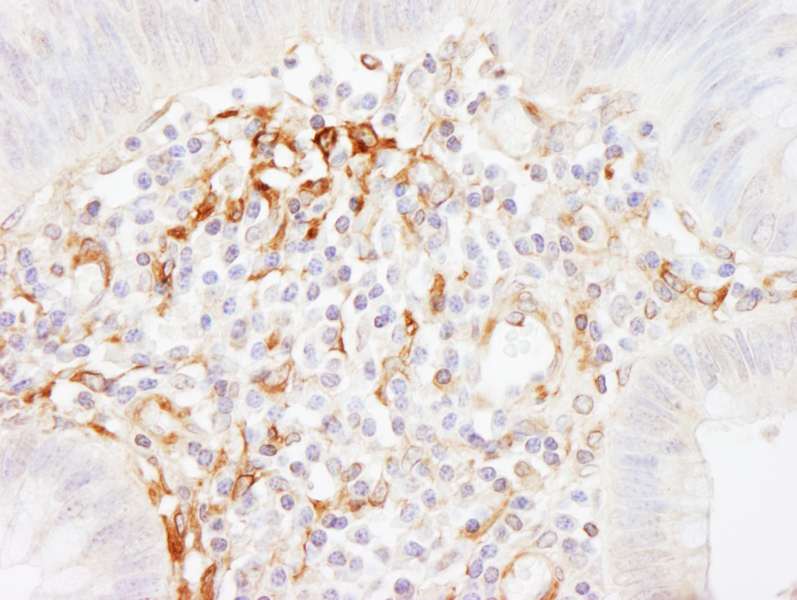 FLNA / Filamin A Antibody (aa400-450)