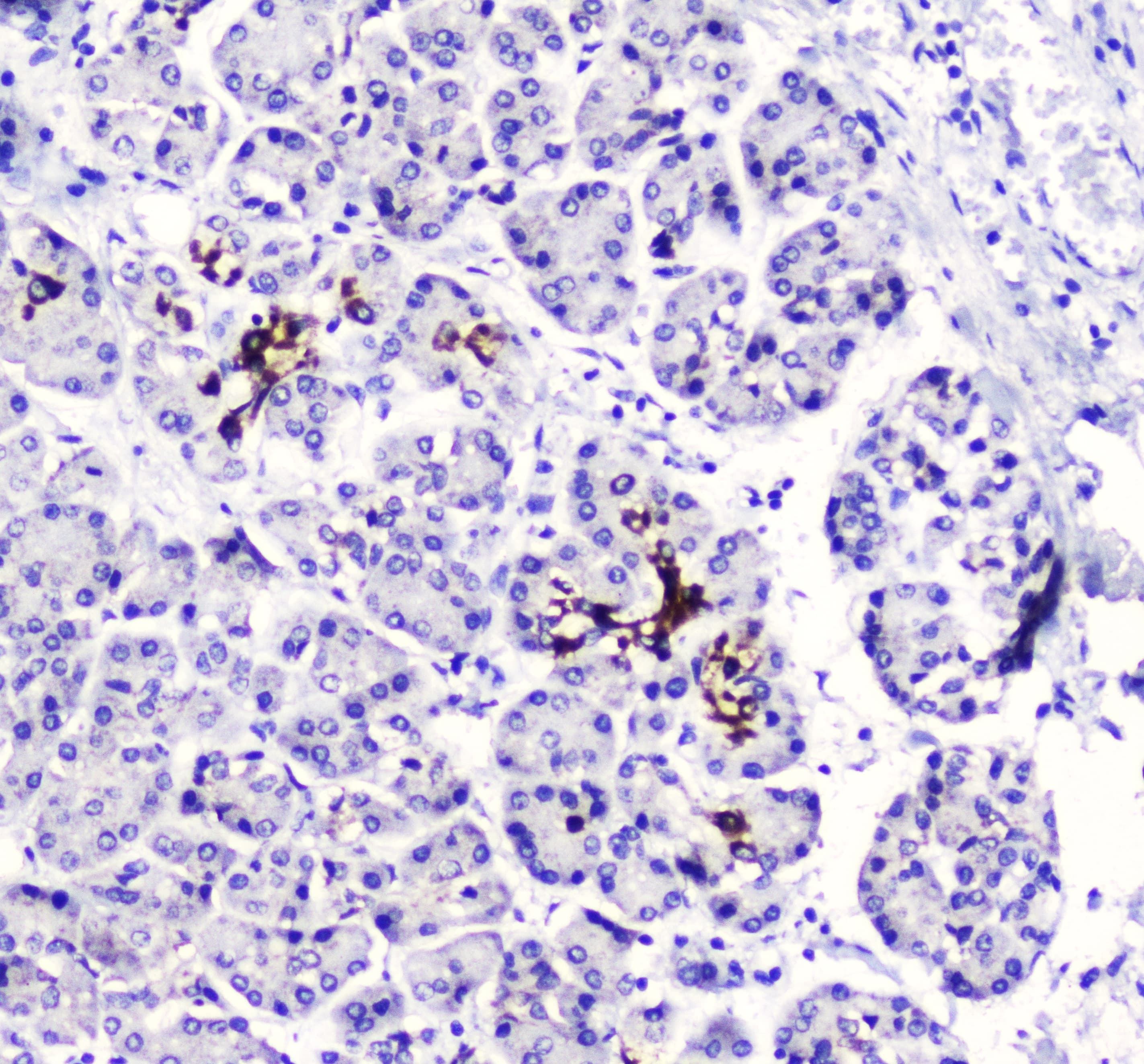 Polyclonal Rabbit anti-Human BTC / Betacellulin Antibody (IHC, WB)