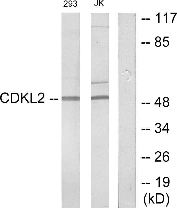 CDKL2 Antibody (aa211-260)