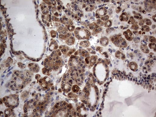 Monoclonal Mouse anti-Human MTDH / Metadherin Antibody (clone OTI2H4, aa70-582, IHC, WB)