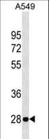 VAPB Antibody (aa171-200)