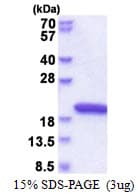 Human NUDCD2 Protein (Recombinant His)