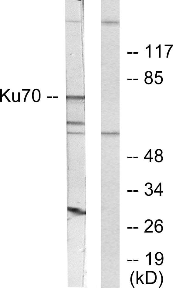 XRCC6 / Ku70 Antibody (p5)