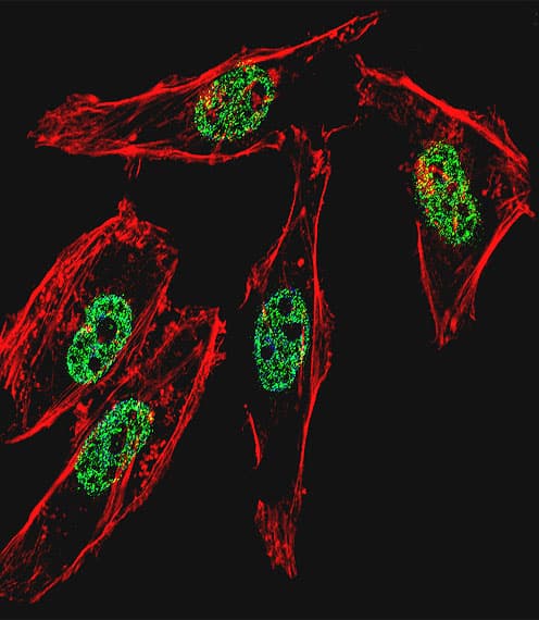 IHC-plus™ MYOD / MYOD1 Antibody (aa211-240)
