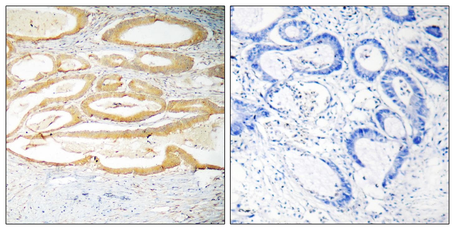 HTRA2 / OMI Antibody (p142)