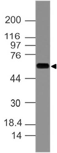 Monoclonal Mouse anti-Human KRT77 / Keratin 77 / KRT1B Antibody (WB)