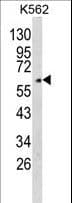 GPC4 / Glypican 4 Antibody (aa395-422)