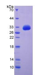 Pig EGF Protein (Recombinant His-S)
