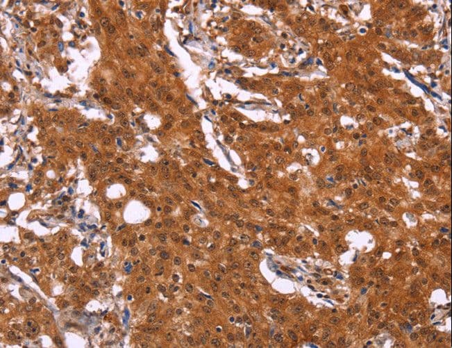 APMAP / C20orf3 Antibody