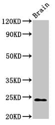 Polyclonal Rabbit anti-Human NDUFS8 Antibody (WB)