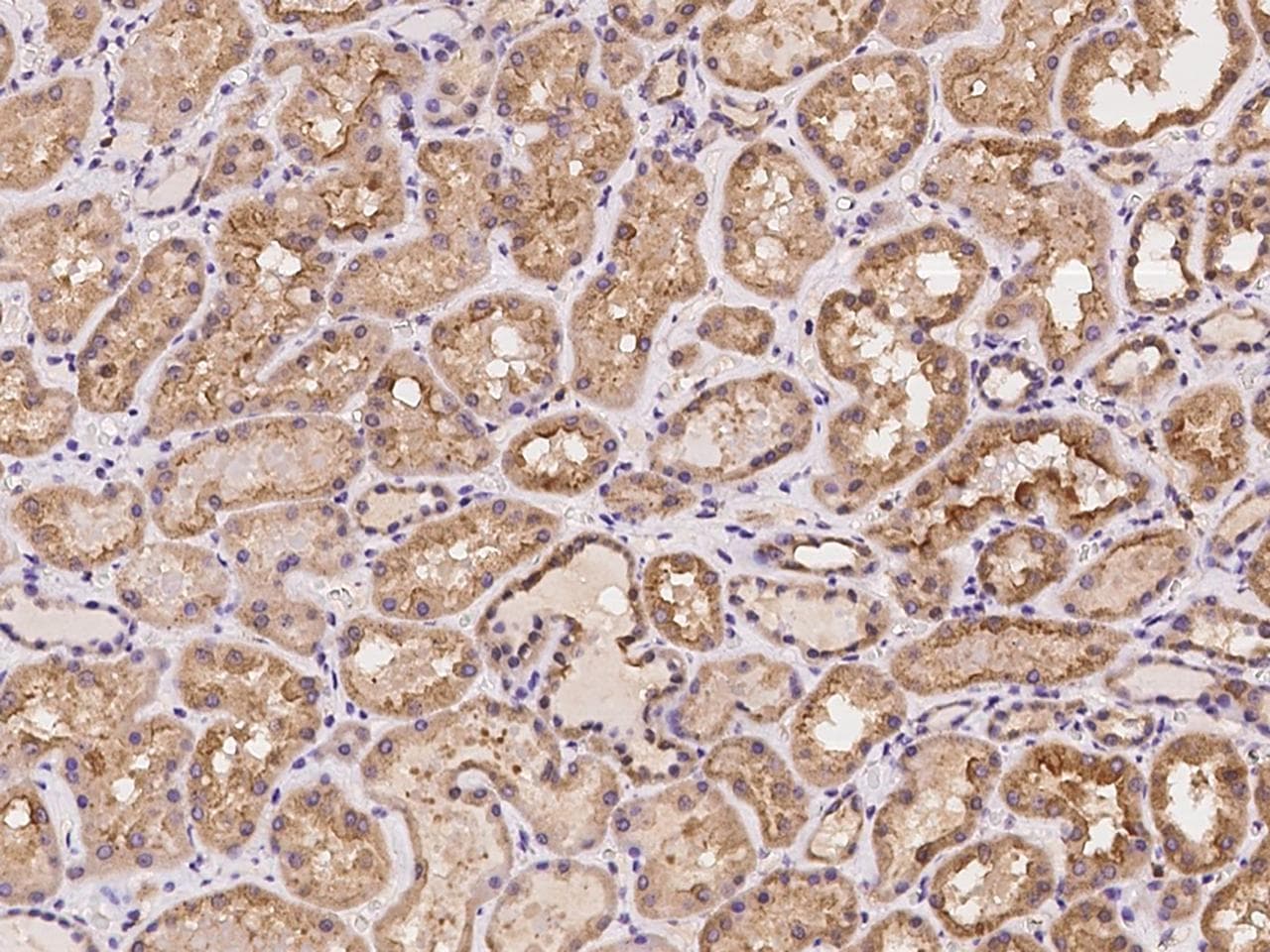 SNX21 Antibody