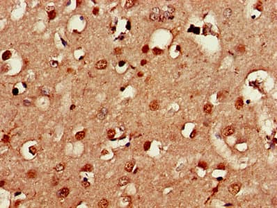 TMEM257 / CXorf1 Antibody