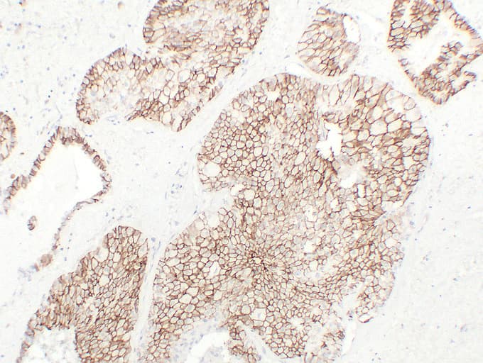 CDH16 / Cadherin 16 Antibody (clone ABT-CDH16)