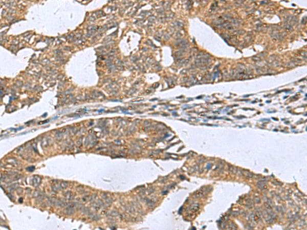 RPL18 / Ribosomal Protein L18 Antibody