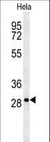 TMEM165 Antibody (aa17-45)