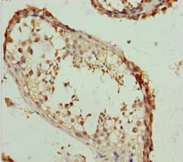 Polyclonal Rabbit anti-Human RACGAP1 / MGCRACGAP Antibody (IHC)
