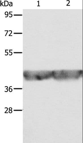 Polyclonal Rabbit anti-Human ALDOA / Aldolase A Antibody (IHC, WB)