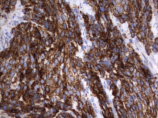 Monoclonal Mouse anti-Human HADH Antibody (clone UMAB151, aa57-314, IHC, WB)