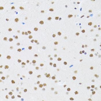 MTA3 Antibody