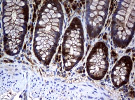 NME1 / NM23 Antibody (clone OTI7D6)