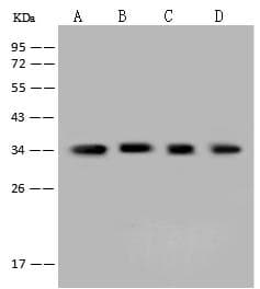 AKR1B1 / Aldose Reductase Antibody