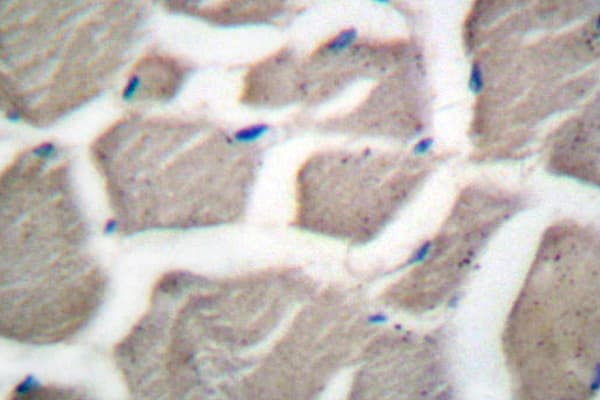 BAK1 / BAK Antibody (Ala2)