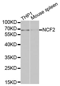 IHC-plus™ Polyclonal Rabbit anti-Human NCF2 / NOXA2 / p67phox Antibody (IHC, IF, WB)