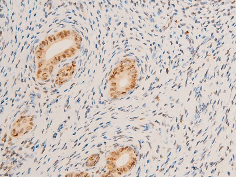 Polyclonal Rabbit anti-Human MYC / c-Myc Antibody (phospho-Ser62, IHC, IF, WB)