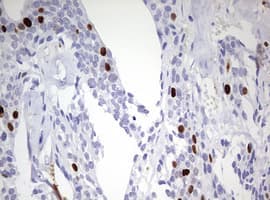 TOP2A / Topoisomerase II Alpha Antibody (aa1100-1531, clone 1D2, Carrier-free)
