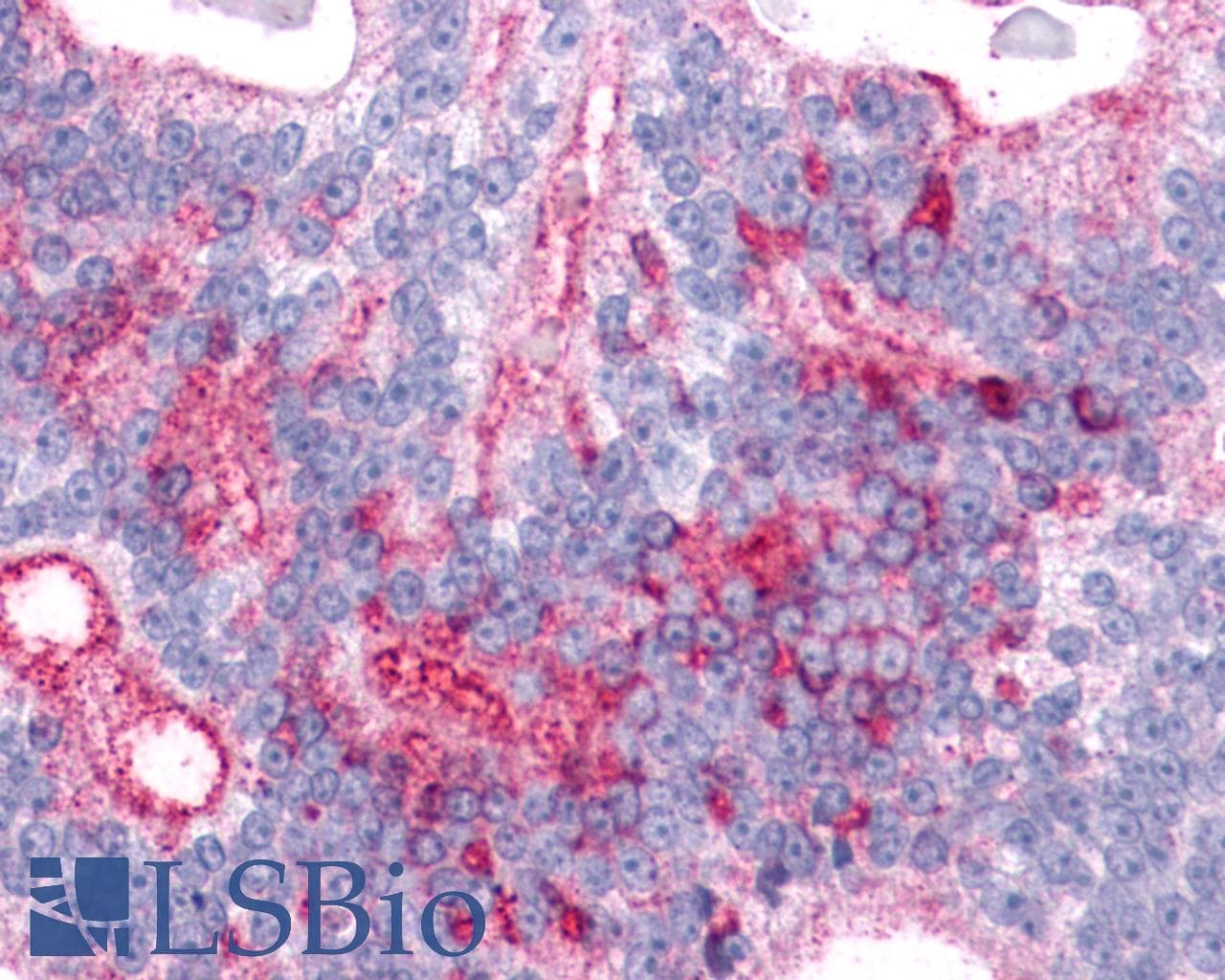 IHC-plus™ ADGRL2 / LPHN2 Antibody (C-Terminus)