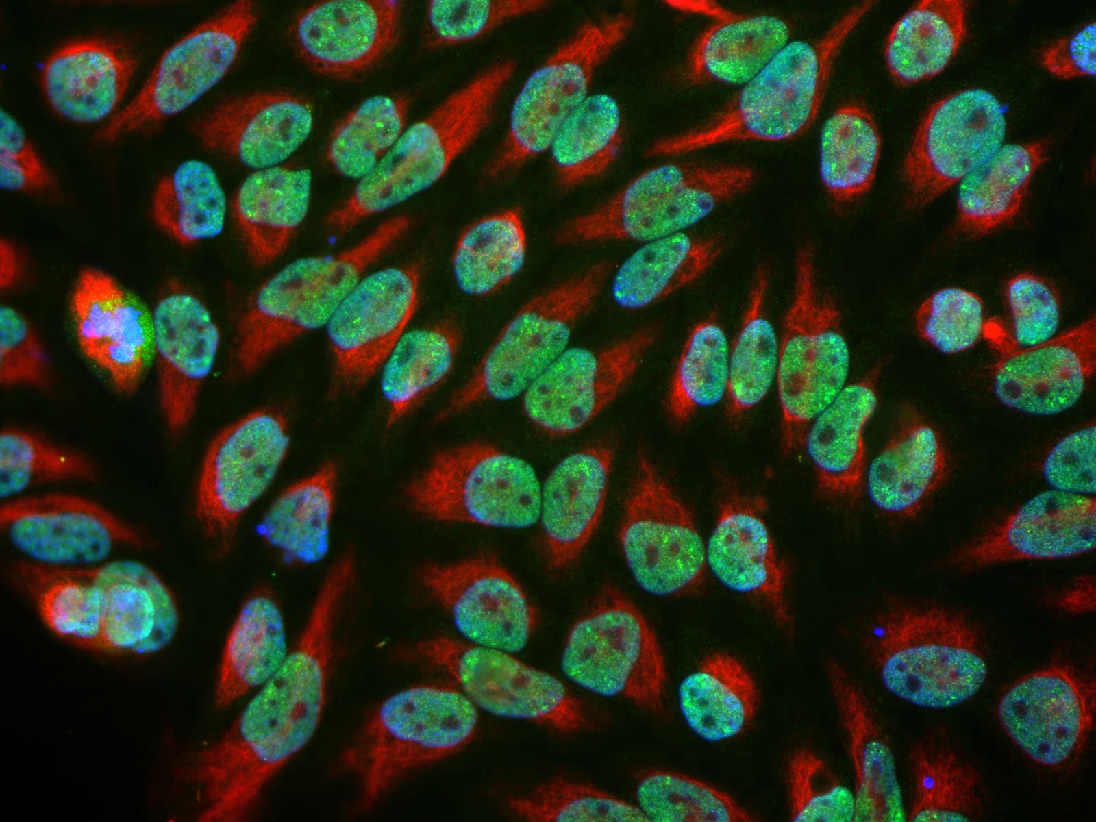 EWSR1 / EWS Antibody (clone 5H7)