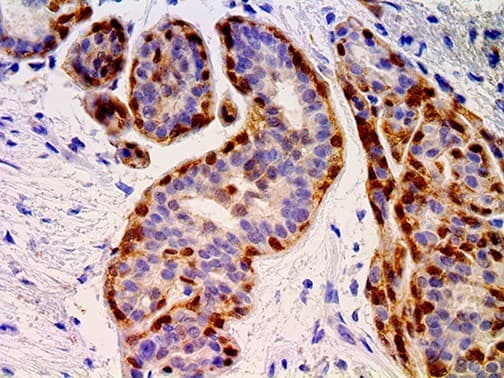 SERPINB5 / Maspin Antibody (Ready-to-Use)