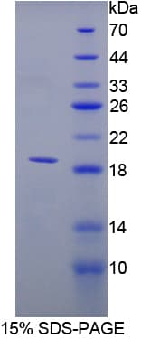 Human Preprovasopressin Protein (Recombinant His-T7)