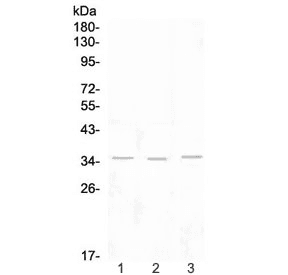KLRK1 / CD314 / NKG2D Antibody