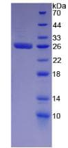 Human GSTA2 Protein (Recombinant His)