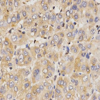 EIF2AK2 / PKR Antibody