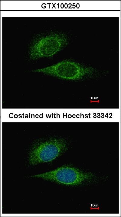 ELF3 / ESE1 Antibody (aa309-371)
