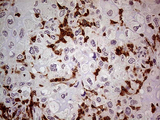 Monoclonal Mouse anti-Human P40PHOX / NCF4 Antibody (clone OTI12H10, IHC)