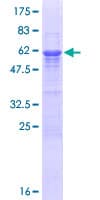 Human IFFO / IFFO1 Protein (Recombinant GST)
