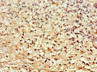 ARNT2 Antibody (aa440-690)
