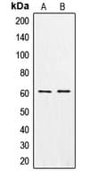 Polyclonal Rabbit anti-Human CSGALNACT1 Antibody (Internal, IHC, WB)