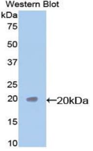 CASP7 / Caspase 7 Antibody (aa24-198, Cy3)