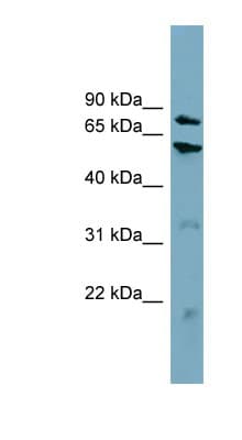 CPT1B Antibody (aa359-408)